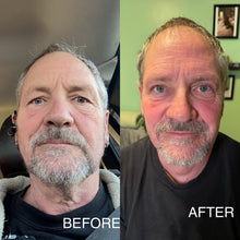 Load image into Gallery viewer, Extensive Buccal Facelift With Lymphatic Drainage & Myofacial Release Treatment (Includes LED Light Therapy) 100 Minutes