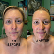 Load image into Gallery viewer, Extensive Buccal Facelift With Lymphatic Drainage & Myofacial Release Treatment (Includes LED Light Therapy) 100 Minutes