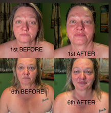 Load image into Gallery viewer, Extensive Buccal Facelift With Lymphatic Drainage &amp; Myofacial Release Treatment (Includes LED Light Therapy) 100 Minutes
